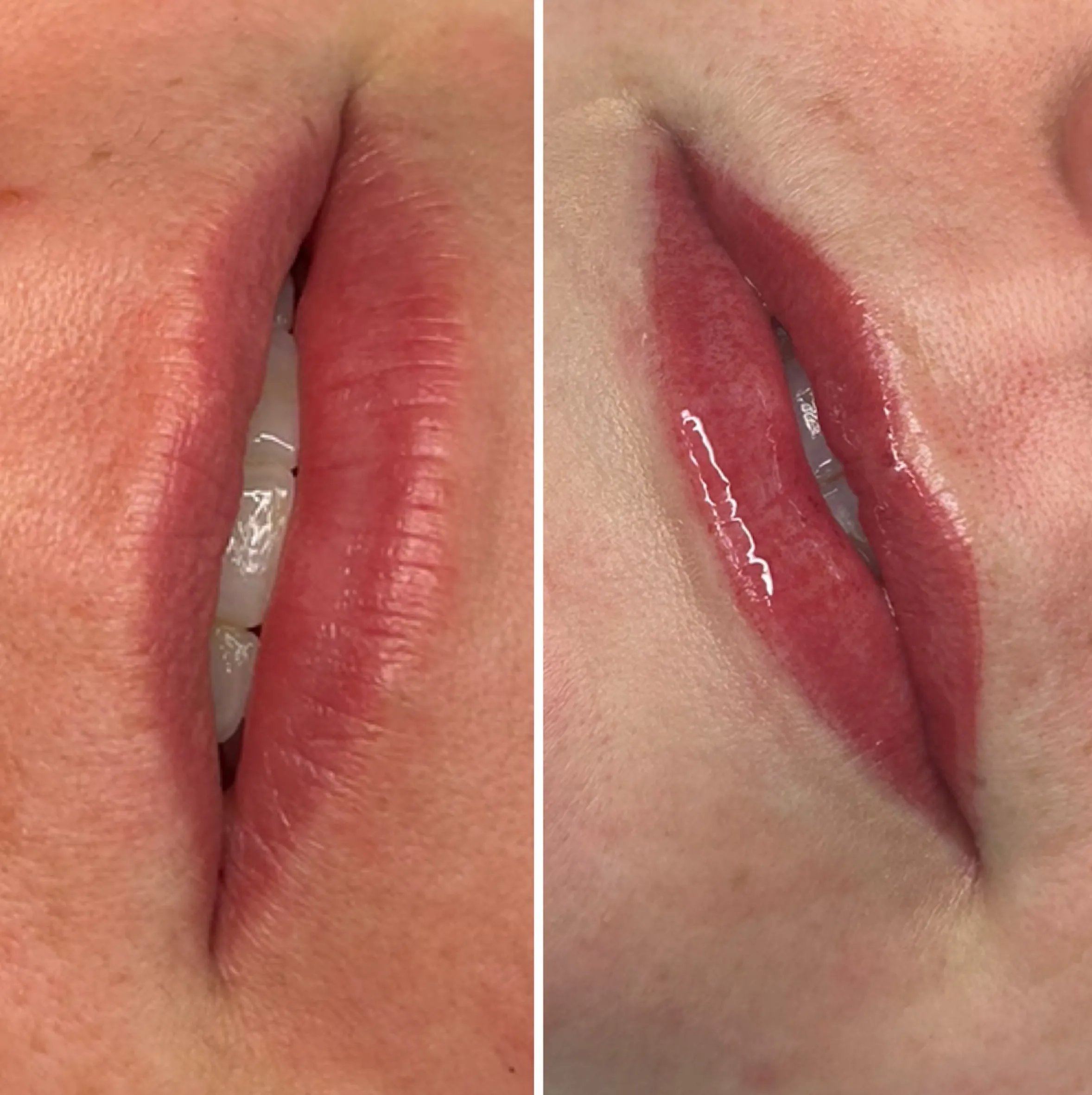 lip tattoo pain scale